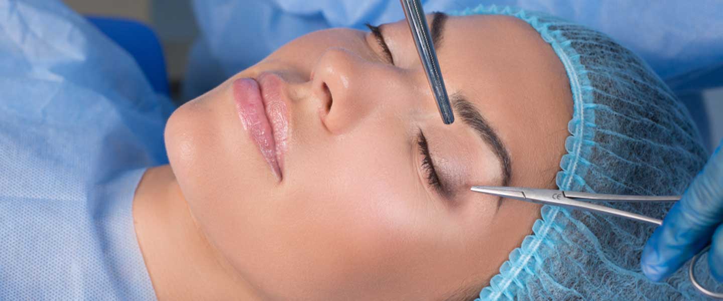 Thẩm mỹ mí mắt (Blepharoplasty) là gì?